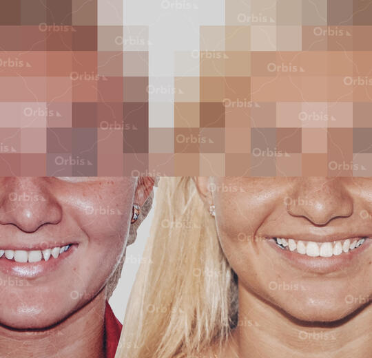 ORBIS