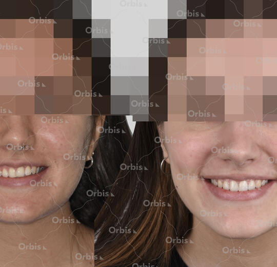 ORBIS