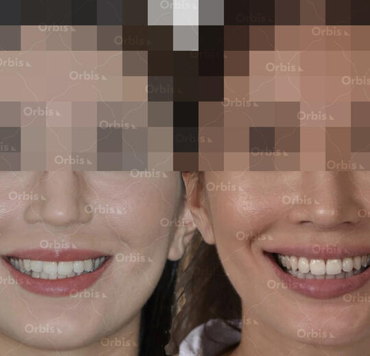 ORBIS