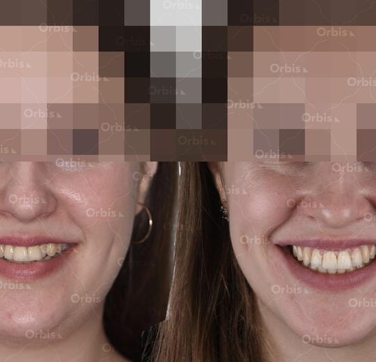 ORBIS