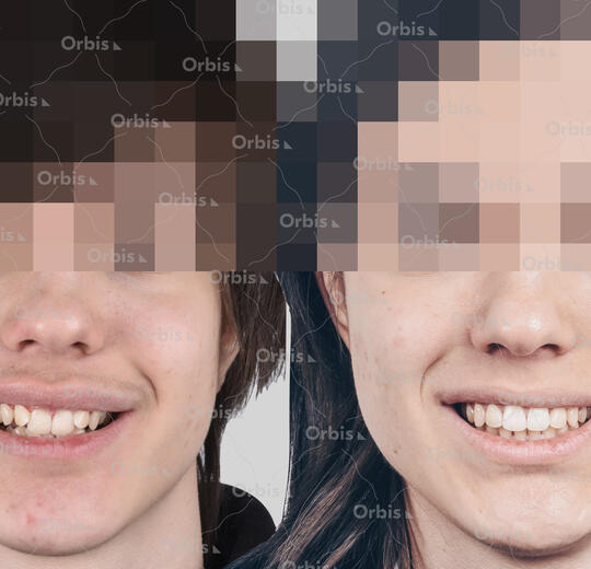 ORBIS