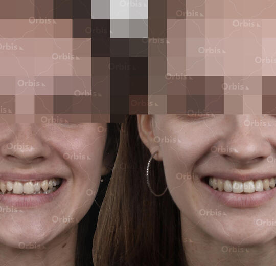 ORBIS